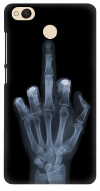 Черный чехол Рентген для Xiaomi Redmi 4x Фак