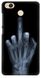 Чорний чохол Рентген для Xiaomi Redmi 4x Фак